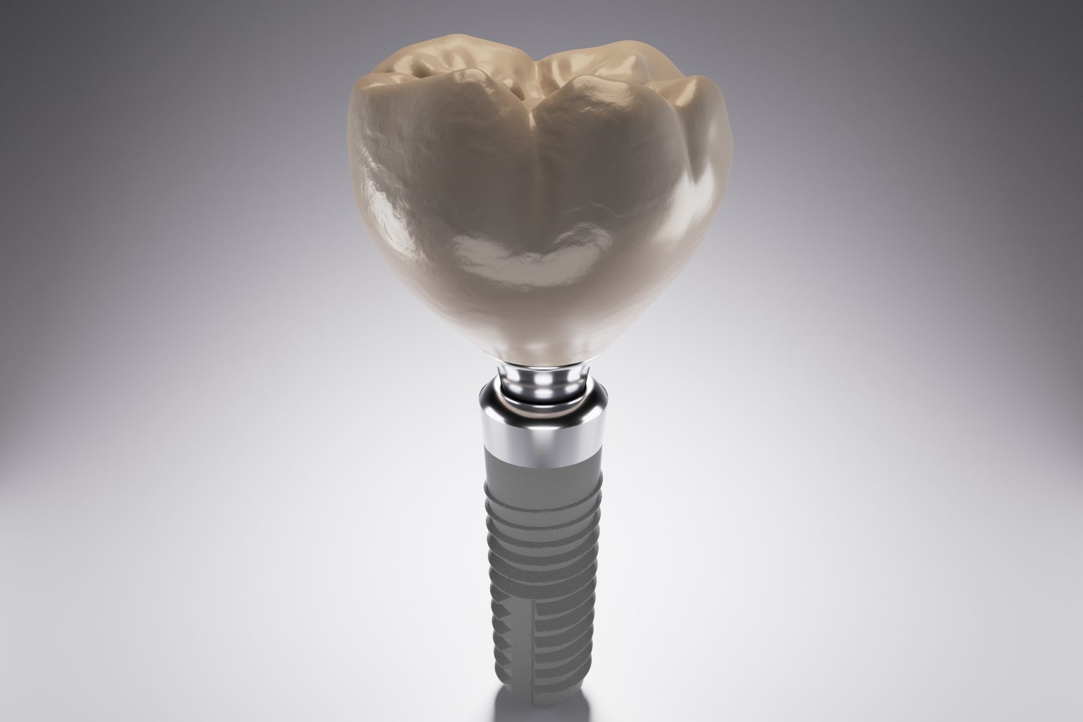 Placing a Realistic Crown For Your Implant Santa Rosa, CA