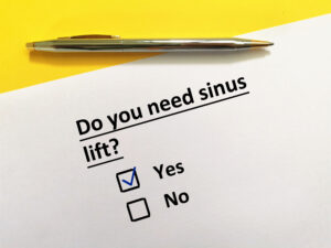 rohnert park sinus lifts