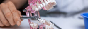 santa rosa dental implant